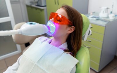 How Often Should You Get Your Teeth Professionally Whitened?