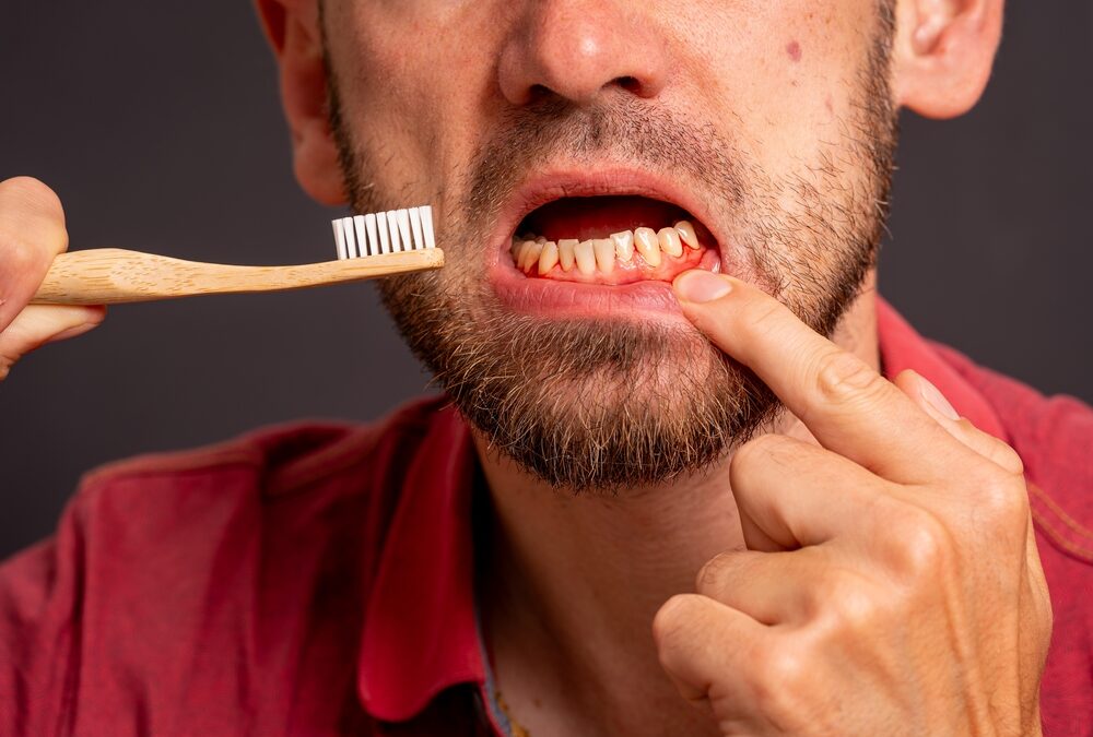 How to Prevent Tooth Decay and Gum Disease?