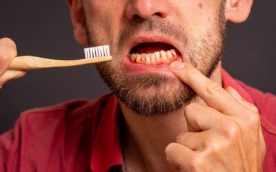 How to Prevent Tooth Decay and Gum Disease?