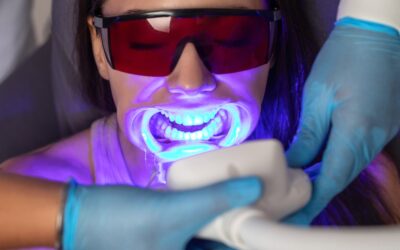 Is Professional Whitening Safe for Sensitive Teeth?